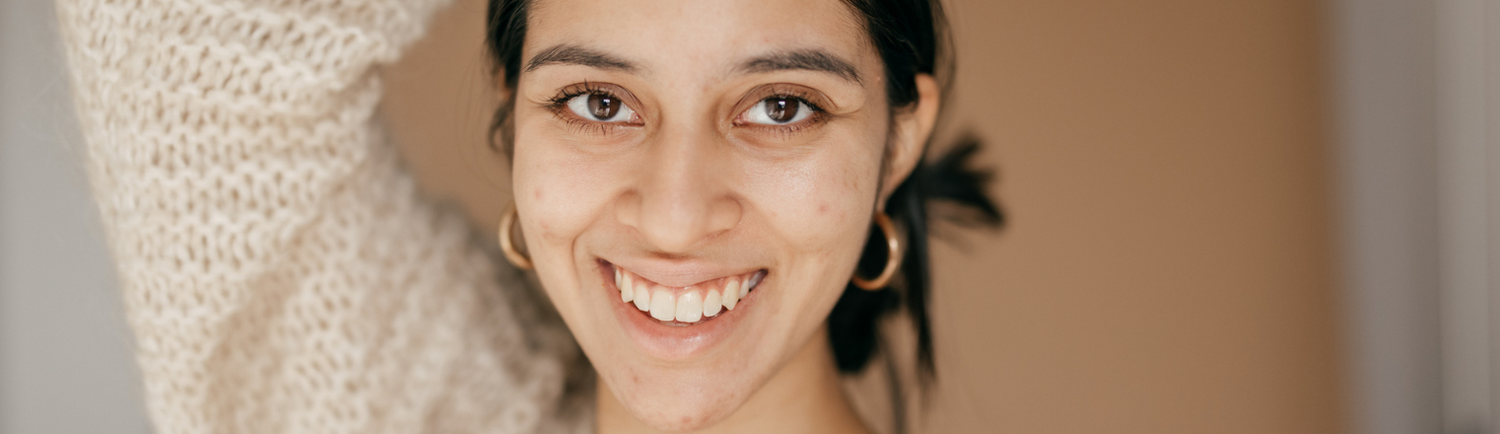 How To Tell If Your Skin Is Breaking Out Or Purging?